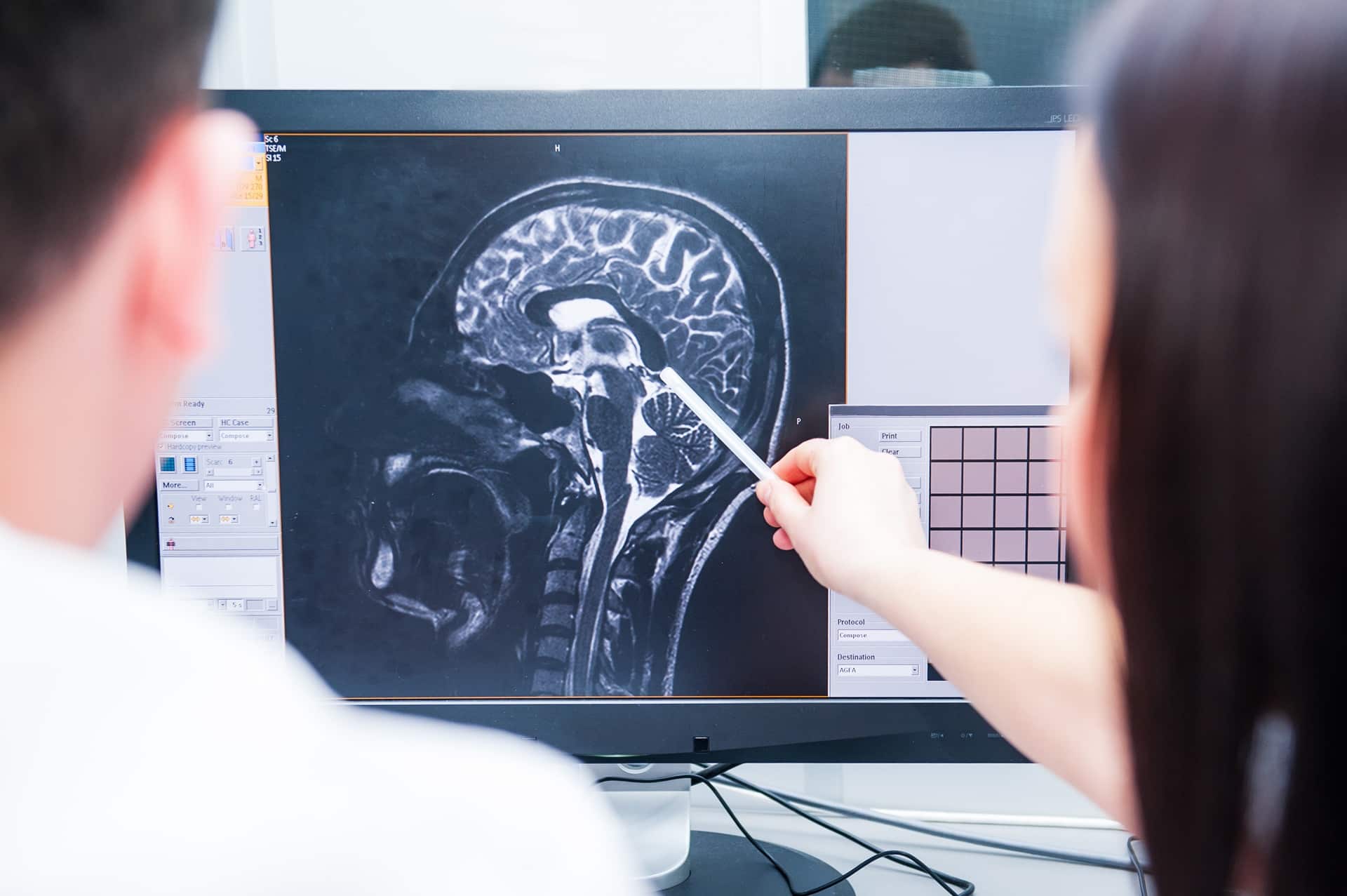 A male doctor and a female doctor look at a brain scan while the female doctor points with a pen at one spot of the x-ray.