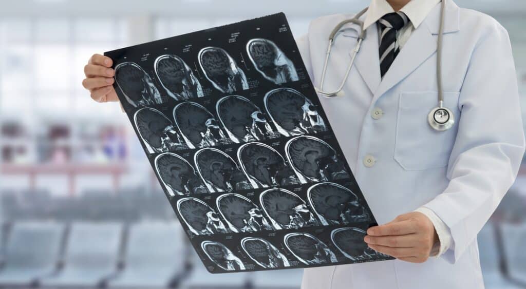 A doctor holding a series of brain x rays in a hospital room.